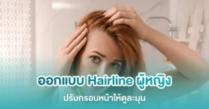 Hairline ผู้หญิง